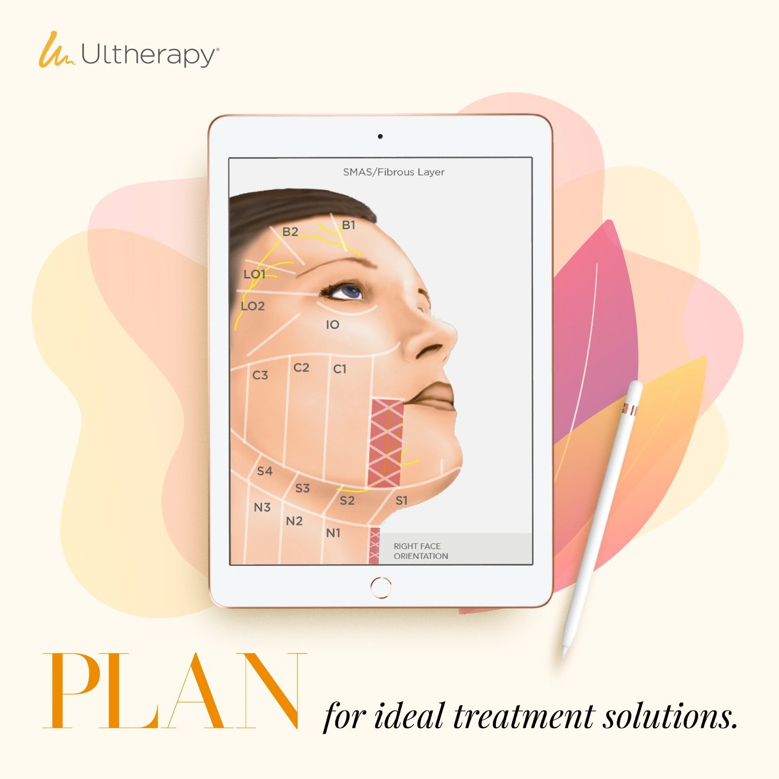 Ultherapy Treatment Plan