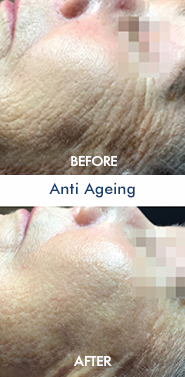 Anti Ageing