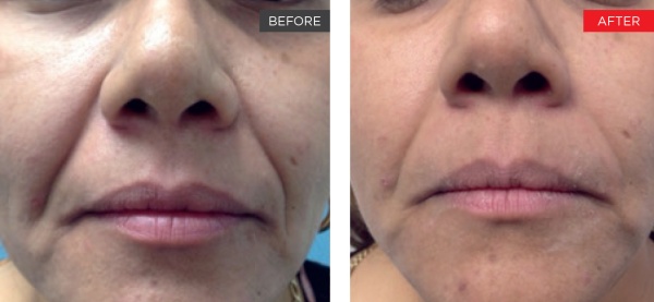 courtesy_of_a_gaspar_md_2