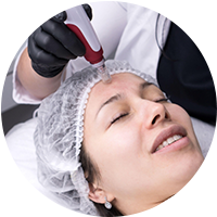Skin Needling + free LED or Power Peel