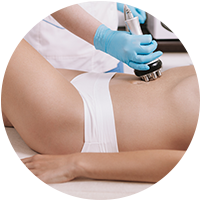 RF Body Contouring – Buy 2 Get 2 Free